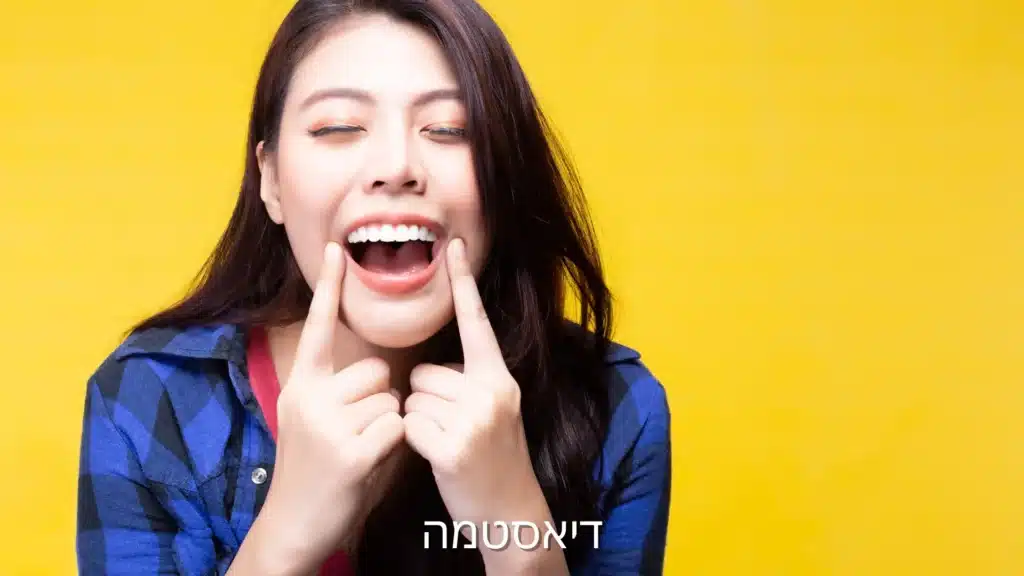 דיאסטמה - תמונה ראשית