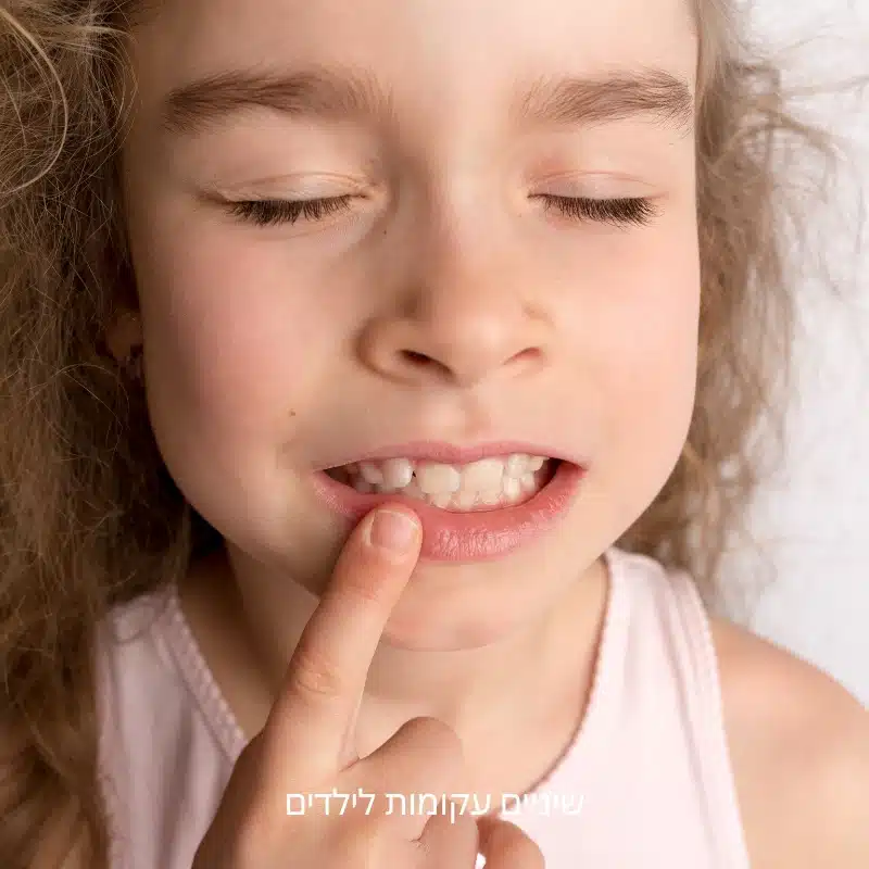 שיניים עקומות לילדים