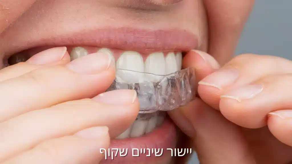 יישור שיניים שקוף באמצעות קשתית אינויזליין מותאמת אישית- דר עומר פלייסיג