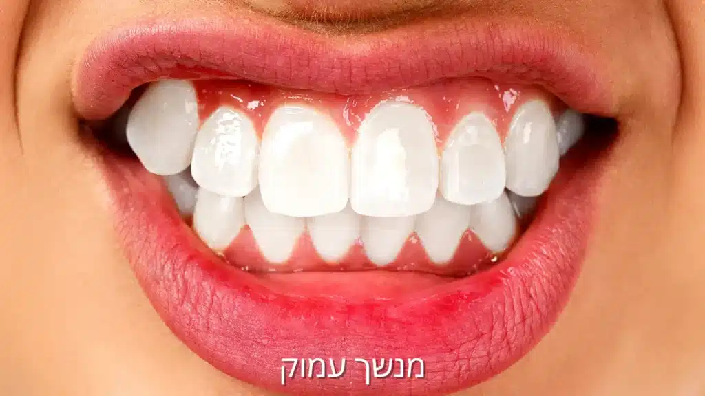 מנשך עמוק -דר עומר פלייסיג