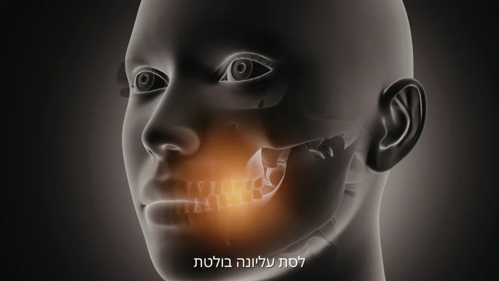 לסת עליונה בולטת – מבנה הלסת וההשפעה על הפנים