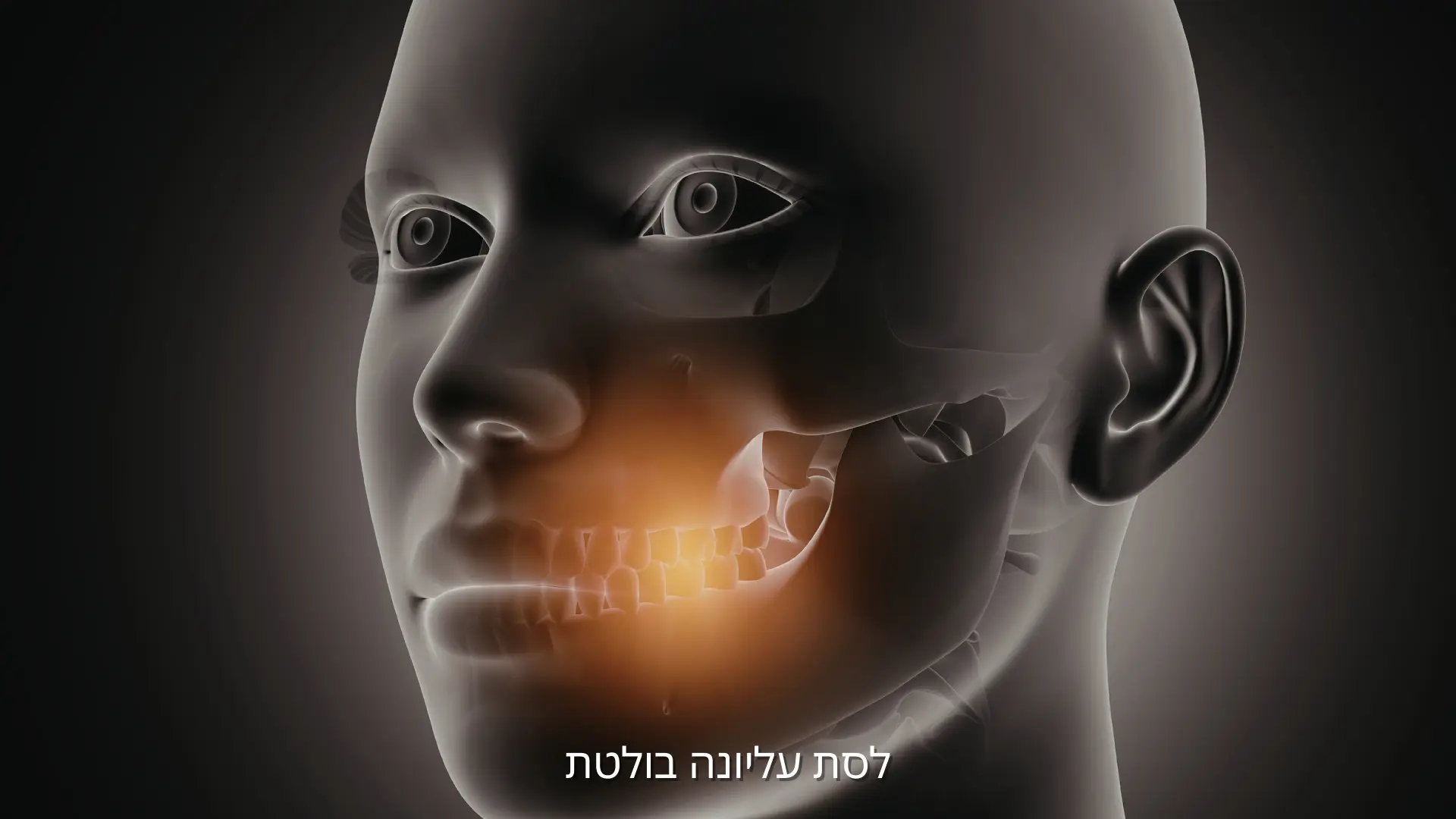 לסת עליונה בולטת – מבנה הלסת וההשפעה על הפנים
