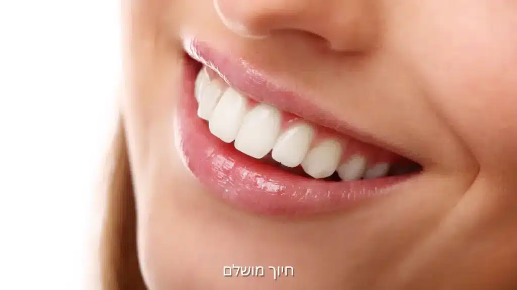 חיוך מושלם עם שיניים ישרות ואסתטיקה טבעית